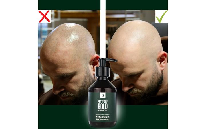 Immagine prodotto Better be bold Senza capelli (200 ml, Shampoo liquido)