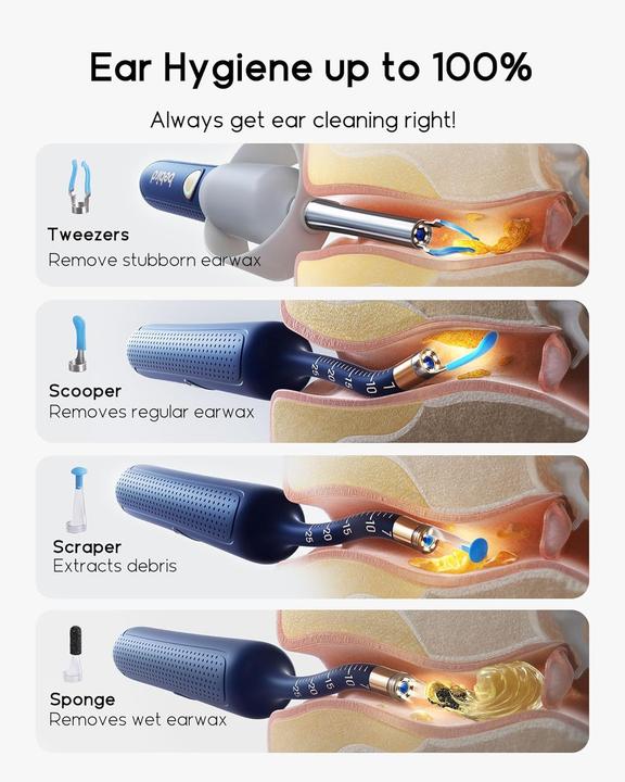 Produktbild Bebird EarSight Plus - Blue