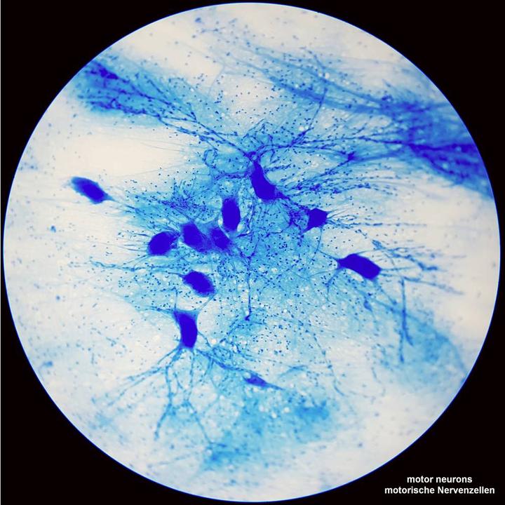 Actual product image Bresser Optik Science TFM-201 Bino transmitted light microscope Binocular 1000 x transmitted light