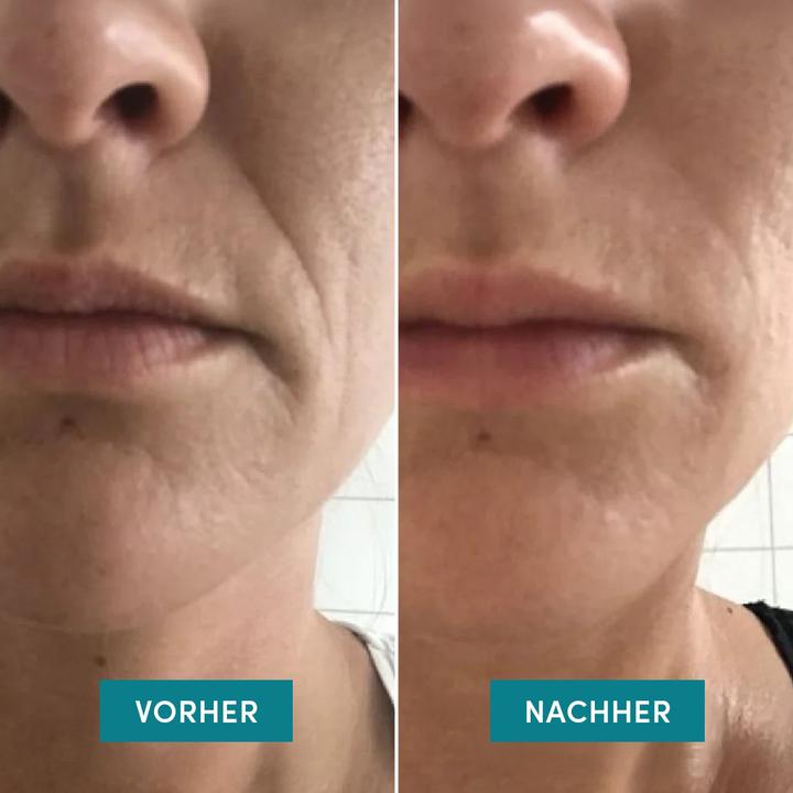 Actual product image Apricot Mouth Patches Aloe Vera "calm before the glow"