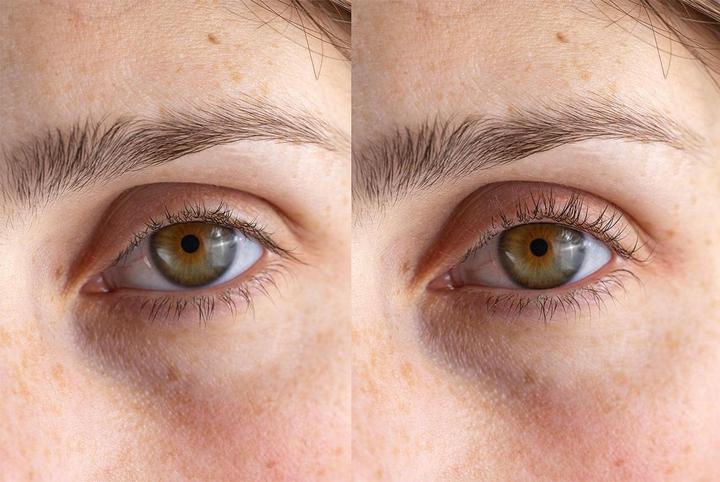 Actual product image TOP Heated eyelash curler