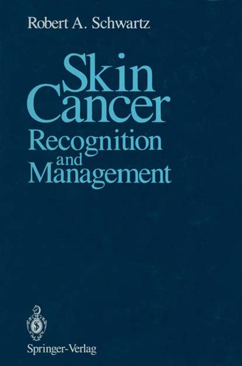 Produktbild Skin Cancer (Robert A. Schwartz, 2012)