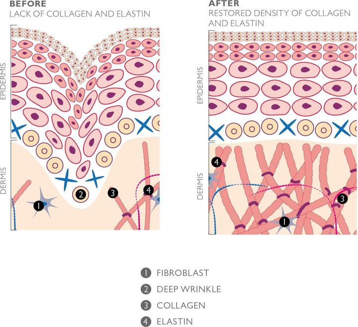Actual product image Silk'n FaceTite Mini