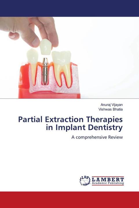 Actual product image Partial Extraction Therapies in Implant Dentistry (German, Anuraj Vijayan, Vishwas Bhatia, 2021)