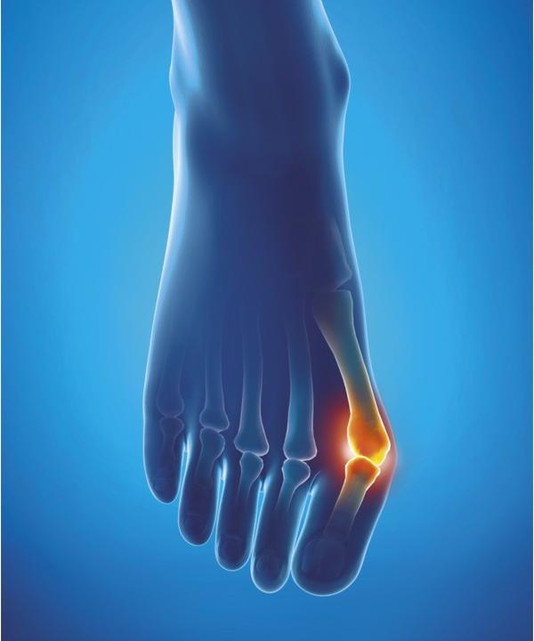 Produktbild Epitact Hallux Valgus Schutz L 27 cm 1 Stück (L)
